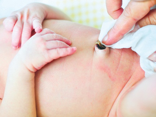 Những điều mẹ cần biết về chăm sóc dây rốn cho bé yêu 37 Những điều mẹ cần biết về chăm sóc dây rốn cho bé yêu 9