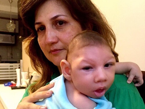 Những khuôn mặt trẻ thơ bị nhiễm virus Zika gây ám ảnh người nhìn 53 Những khuôn mặt trẻ thơ bị nhiễm virus Zika gây ám ảnh người nhìn 25