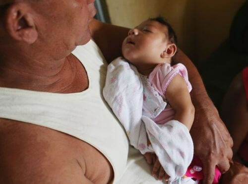 Những khuôn mặt trẻ thơ bị nhiễm virus Zika gây ám ảnh người nhìn 63 Những khuôn mặt trẻ thơ bị nhiễm virus Zika gây ám ảnh người nhìn 35