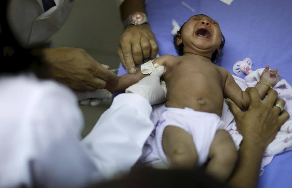 Những khuôn mặt trẻ thơ bị nhiễm virus Zika gây ám ảnh người nhìn 65 Những khuôn mặt trẻ thơ bị nhiễm virus Zika gây ám ảnh người nhìn 37