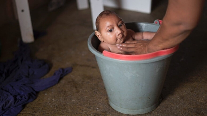 Những khuôn mặt trẻ thơ bị nhiễm virus Zika gây ám ảnh người nhìn 66 Những khuôn mặt trẻ thơ bị nhiễm virus Zika gây ám ảnh người nhìn 38