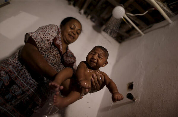 Những khuôn mặt trẻ thơ bị nhiễm virus Zika gây ám ảnh người nhìn 67 Những khuôn mặt trẻ thơ bị nhiễm virus Zika gây ám ảnh người nhìn 39