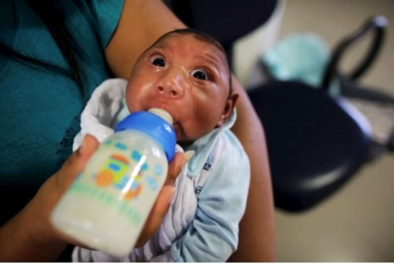 Những khuôn mặt trẻ thơ bị nhiễm virus Zika gây ám ảnh người nhìn 71 Những khuôn mặt trẻ thơ bị nhiễm virus Zika gây ám ảnh người nhìn 43