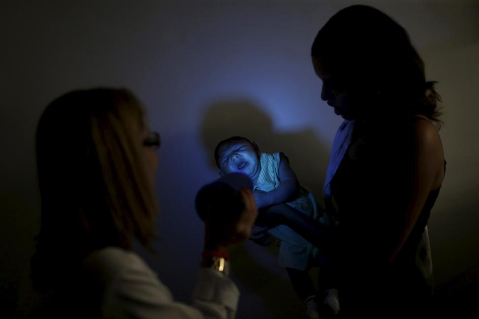 Những khuôn mặt trẻ thơ bị nhiễm virus Zika gây ám ảnh người nhìn 54 Những khuôn mặt trẻ thơ bị nhiễm virus Zika gây ám ảnh người nhìn 26