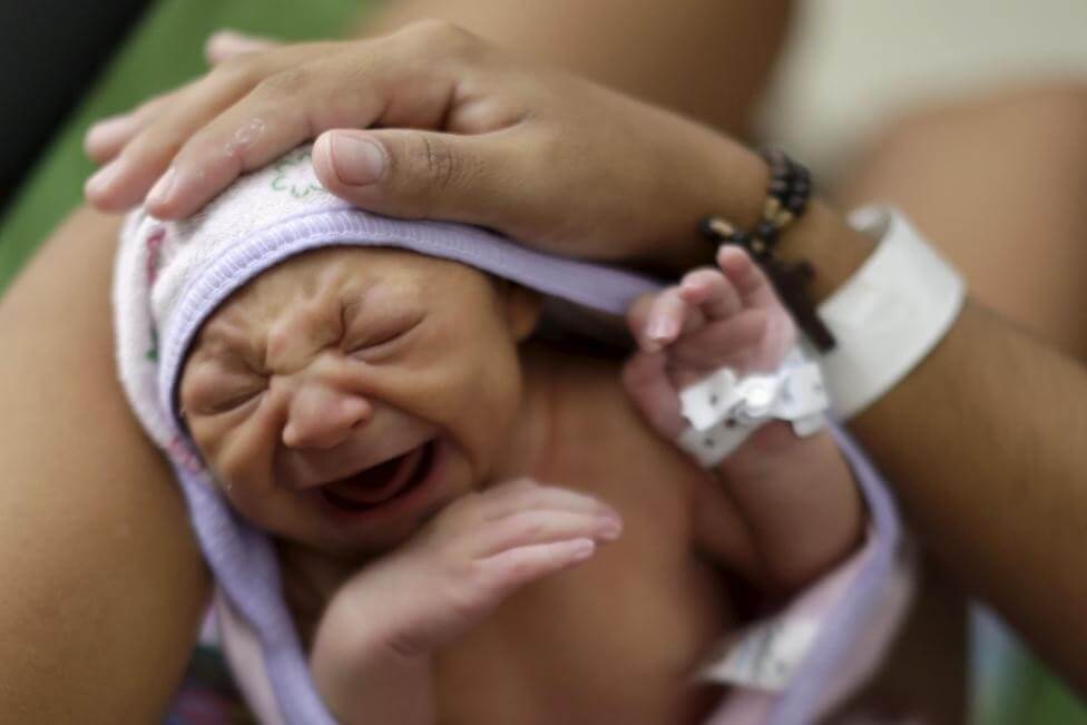 Những khuôn mặt trẻ thơ bị nhiễm virus Zika gây ám ảnh người nhìn 55 Những khuôn mặt trẻ thơ bị nhiễm virus Zika gây ám ảnh người nhìn 27