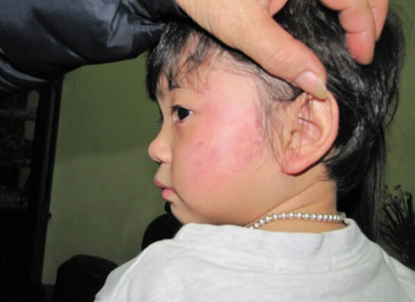 Nói mẹ nghe, ai đánh con thế này? 33 Nói mẹ nghe, ai đánh con thế này? 5