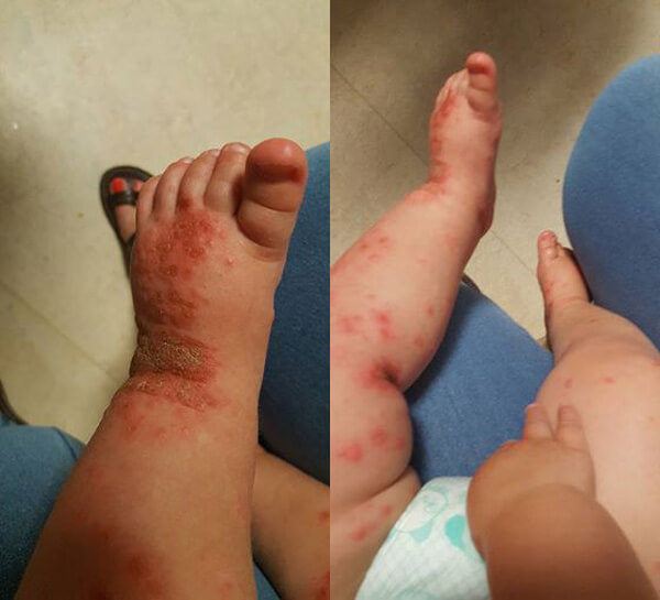 Nụ hôn gieo rắc những nỗi đau 36 Nụ hôn gieo rắc những nỗi đau 8