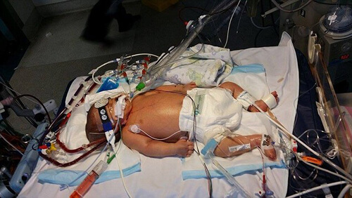 Nụ hôn gieo rắc những nỗi đau 39 Nụ hôn gieo rắc những nỗi đau 11