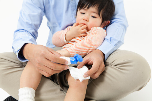 Phân loại phỏng và cách sơ cứu khi bé bị phỏng 34 Phân loại phỏng và cách sơ cứu khi bé bị phỏng 6