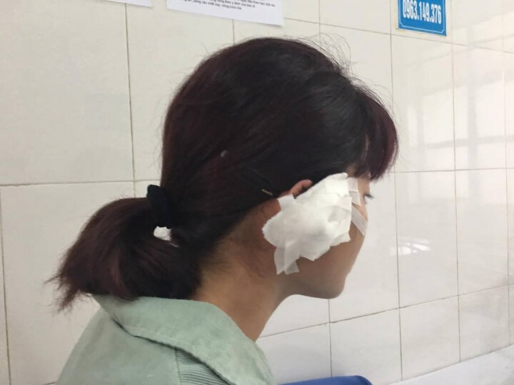 Phụ huynh cắn đứt tai giáo viên vì bức xúc cách dạy con 39 Phụ huynh cắn đứt tai giáo viên vì bức xúc cách dạy con 11