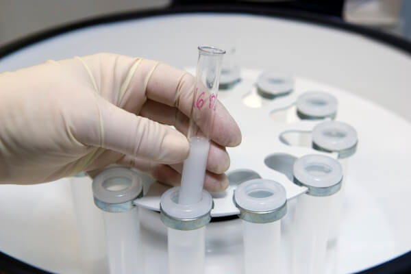 Quá nhiều hóc-môn FSH sẽ làm giảm tỷ lệ thành công của phương pháp IVF 7