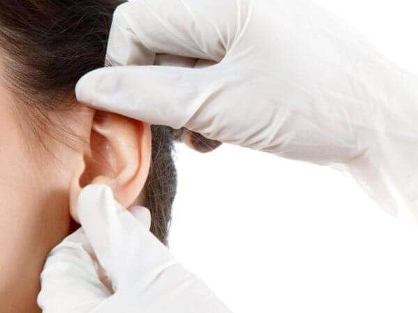 Rò luân nhĩ ở trẻ em 35 ro-luan-nhi-o-tre-em