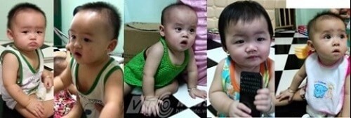 Rơi nước mắt với ca sinh 5 đầu tiên tại Việt Nam 35 roi-nuoc-mat-voi-ca-sinh-5-dau-tien-tai-viet-nam