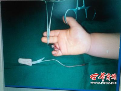 Rùng mình với những vụ tai nạn thang cuốn kinh hoàng 34 Rùng mình với những vụ tai nạn thang cuốn kinh hoàng 6
