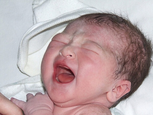Sai lầm cha mẹ hay mắc phải khi "trị bệnh" vặn mình ở trẻ 5