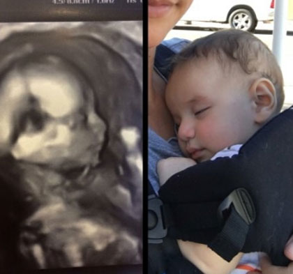 So sánh vui giữa các bé và ảnh siêu âm của mình 48 So sánh vui giữa các bé và ảnh siêu âm của mình 20