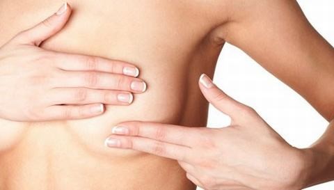 Tá hỏa vì ngực tiết sữa bất thường do u não 33 Tá hỏa vì ngực tiết sữa bất thường do u não 5