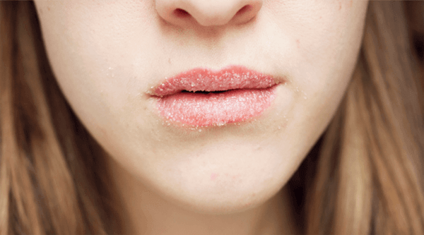 Tẩy tế bào chết cho môi rất dễ chỉ cần đường và muối 37 tay te bao chet cho moi