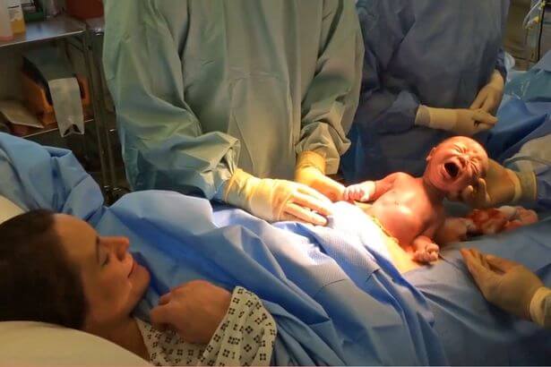 Thiêng liêng khoảnh khắc em bé sinh mổ tự chui ra khỏi bụng mẹ 9
