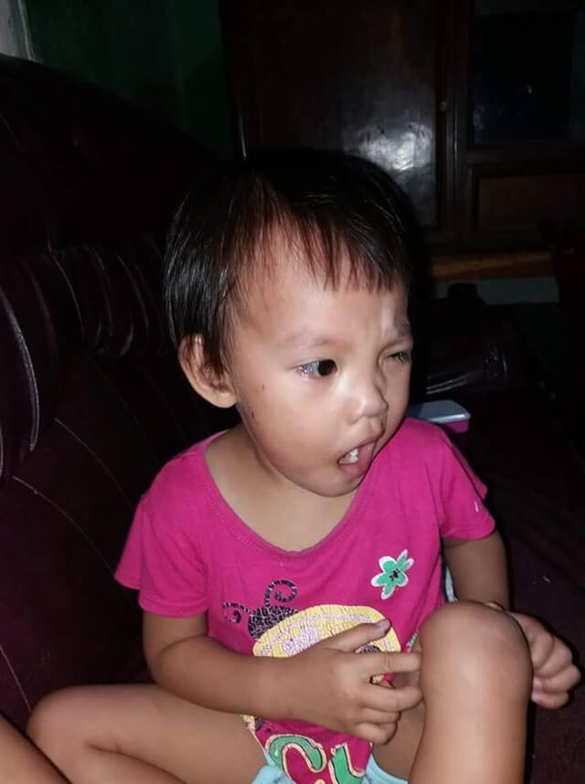 Thói quen tưởng như vô hại của mẹ lại khiến con bị méo miệng, liệt mặt 37 Thói quen tưởng như vô hại của mẹ lại khiến con bị méo miệng, liệt mặt 9