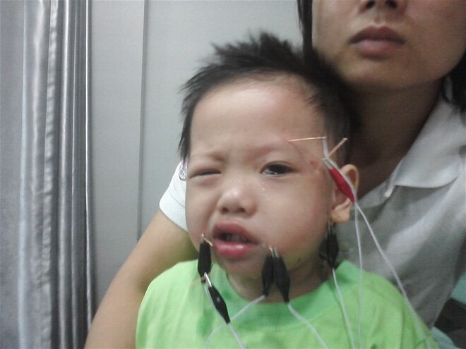Thói quen tưởng như vô hại của mẹ lại khiến con bị méo miệng, liệt mặt 39 Thói quen tưởng như vô hại của mẹ lại khiến con bị méo miệng, liệt mặt 11