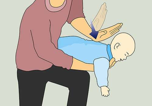 Thủ thuật xử trí khi trẻ hóc dị vật 38 xử trí trẻ hóc dị vật