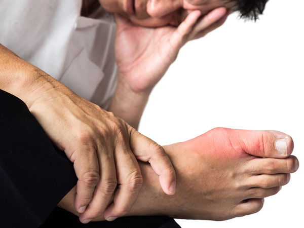 Thức uống khiến bệnh gút phải lùi xa 33 Thức uống khiến bệnh gút phải lùi xa 5