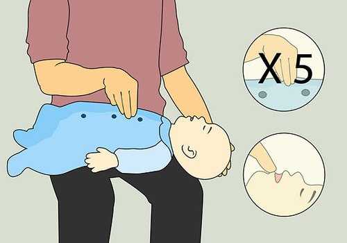 Trẻ bị hóc dị vật: Cách xử lý sai lầm của người lớn 41 trẻ bị hóc dị vật 4