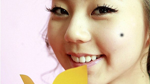 Tự tẩy nốt ruồi an toàn bằng phương pháp tự nhiên 35 tu-tay-not-ruoi-an-toan-bang-phuong-phap-tu-nhien