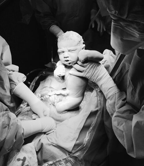 Tuyệt đẹp khoảnh khắc bé yêu rời khỏi bụng mẹ 45 mo