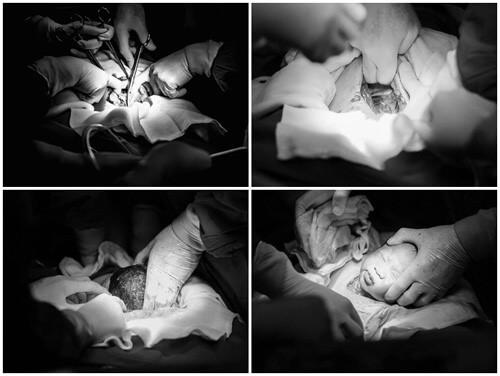 Tuyệt đẹp khoảnh khắc bé yêu rời khỏi bụng mẹ 48 mo