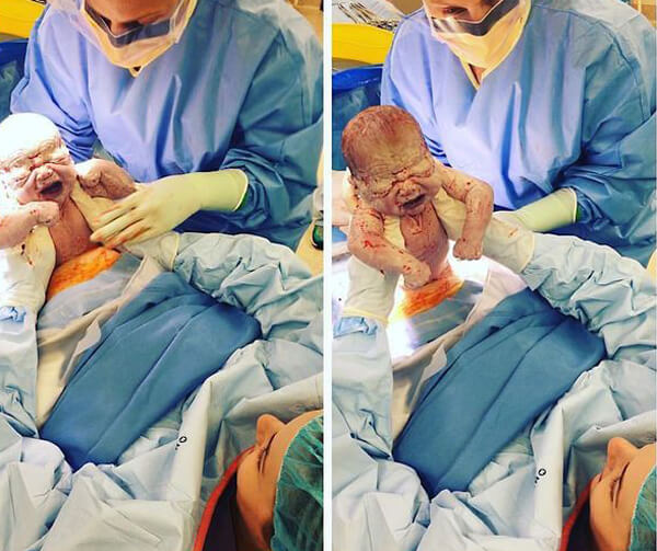 Tuyệt đẹp khoảnh khắc bé yêu rời khỏi bụng mẹ 51 mo