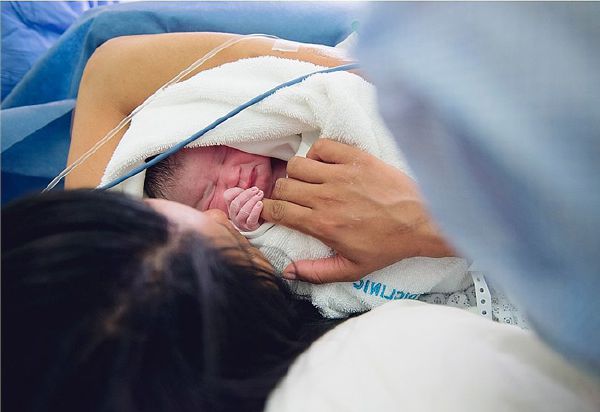 Vào phòng đẻ xem chi tiết một ca sinh mổ 60 Vào phòng đẻ xem chi tiết một ca sinh mổ 33