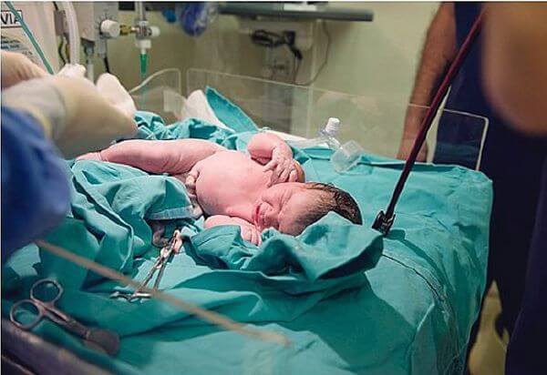 Vào phòng đẻ xem chi tiết một ca sinh mổ 57 Vào phòng đẻ xem chi tiết một ca sinh mổ 30