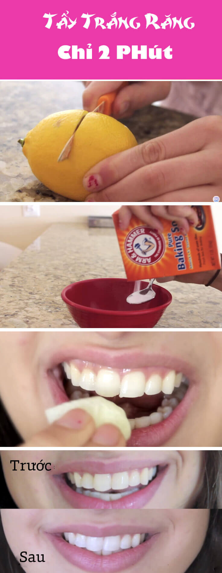 Video: Tẩy răng trắng sáng chỉ trong 2 phút bằng chanh tươi 33 Video: Tẩy răng trắng sáng chỉ trong 2 phút bằng chanh tươi 5