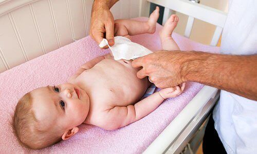 4 sai lầm thường gặp khi chăm sóc rốn cho trẻ sơ sinh 6