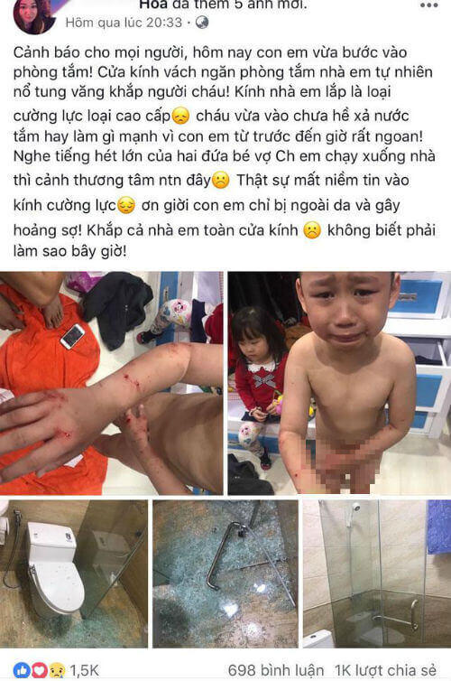Bé trai bị thương do kính cường lực nhà tắm phát nổ 34 Bé trai bị thương do kính cường lực nhà tắm phát nổ 7