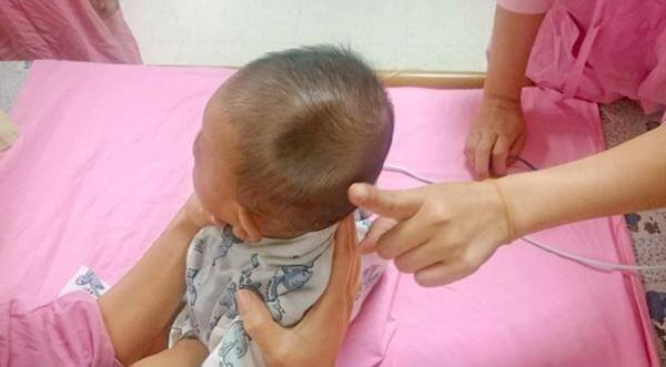 Cha mẹ cẩu thả khiến bé 4 tuổi tai nạn thương tích rùng mình 35 Cha mẹ cẩu thả khiến bé 4 tuổi tai nạn thương tích rùng mình 7