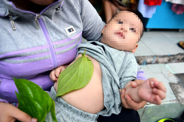Cháu bỏng nặng vì bà đắp lá trầu không trị sổ mũi 33 Cháu bỏng nặng vì bà đắp lá trầu không trị sổ mũi 5