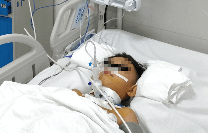 Chơi xe trượt điện, bé trai bị vỡ thanh quản 34 Chơi xe trượt điện, bé trai bị vỡ thanh quản 6