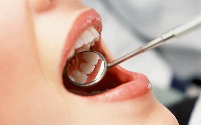 Giải đáp thắc mắc: Nhổ răng khôn có đau không? 33 Giải đáp thắc mắc: Nhổ răng khôn có đau không? 5
