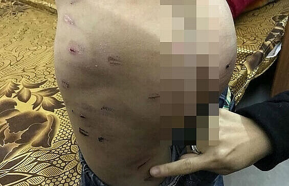 Lại xuất hiện vụ bạo hành trẻ em từ một người bố 38 Lại xuất hiện vụ bạo hành trẻ em từ một người bố 10