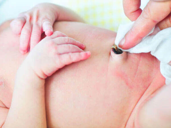 Mách mẹ về cách chăm sóc rốn trẻ sơ sinh đúng chuẩn 7
