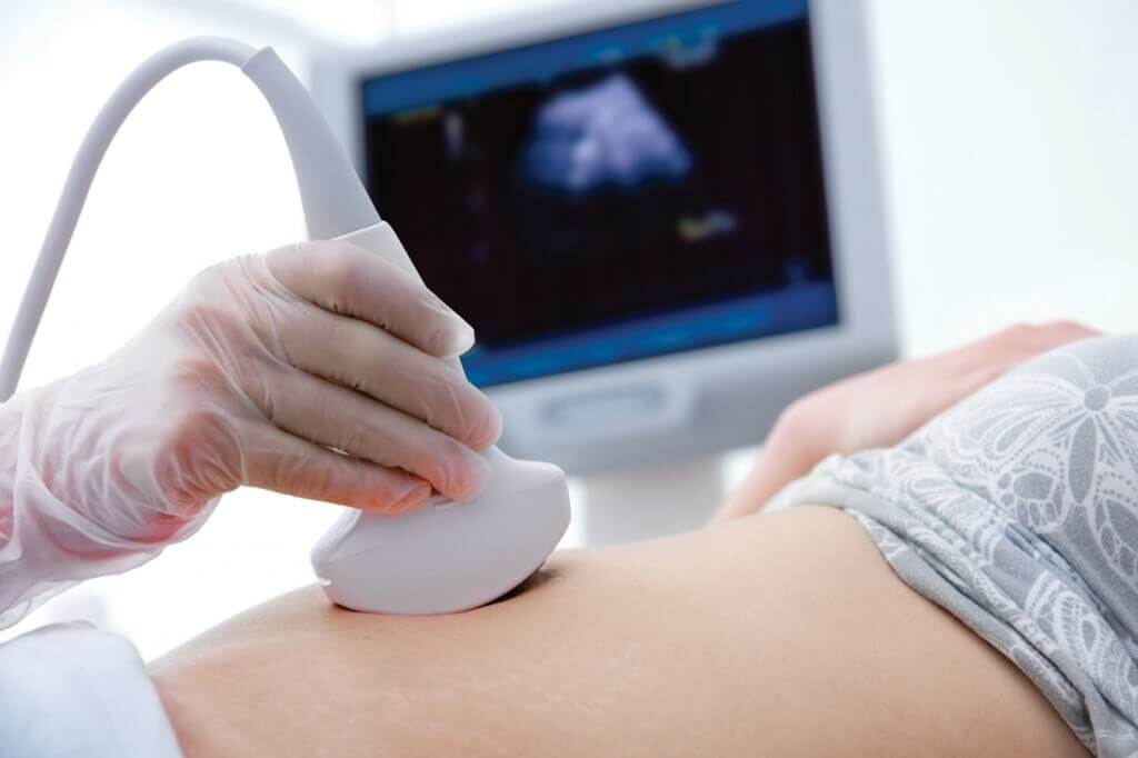 Mẹ bầu siêu âm thai nhiều có tốt không? 35 Mẹ bầu siêu âm thai nhiều có tốt không? 7