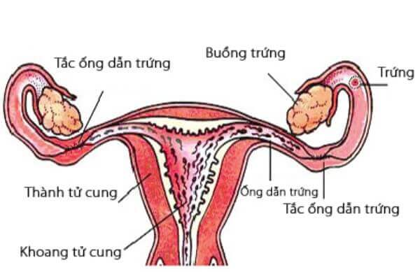 Nếu bị tắc vòi trứng có chữa được không? 33 Nếu bị tắc vòi trứng có chữa được không? 5