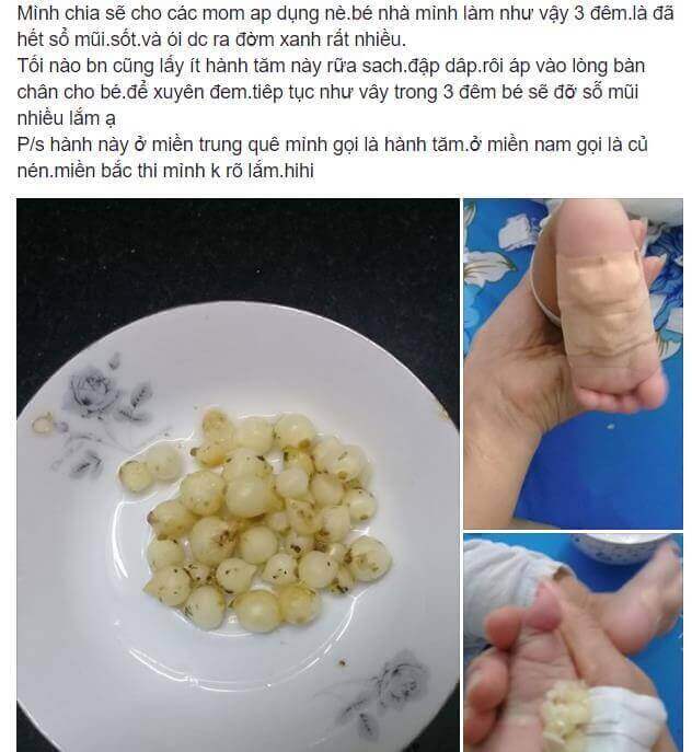 Thực hư cách chữa sổ mũi cho bé bằng dân gian 6