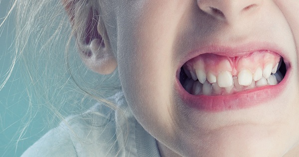 Trẻ nghiến răng khi ngủ phải làm sao? 33 Trẻ nghiến răng khi ngủ phải làm sao? 5
