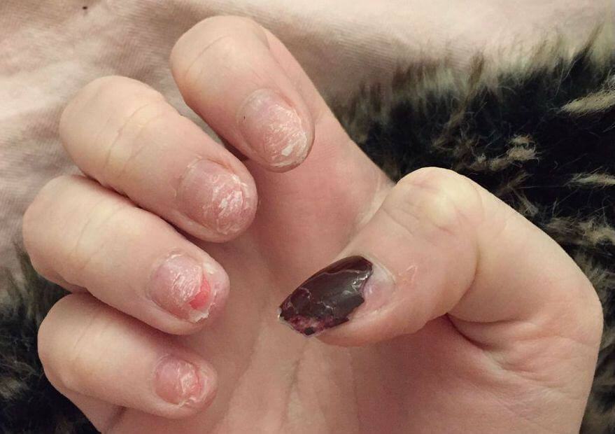 Sơn móng gel: Đẹp ngoài, hại trong các nàng đã biết chưa? 16 tác hại sơn móng gel