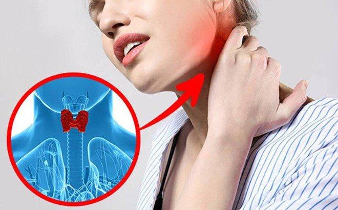 Tuyến giáp ơi, sao lại quan trọng thế? 6