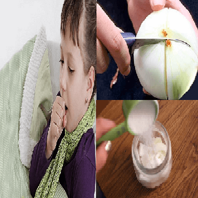 Mách mẹ 3 bài thuốc trị ho ngày lạnh từ hành tây 6
